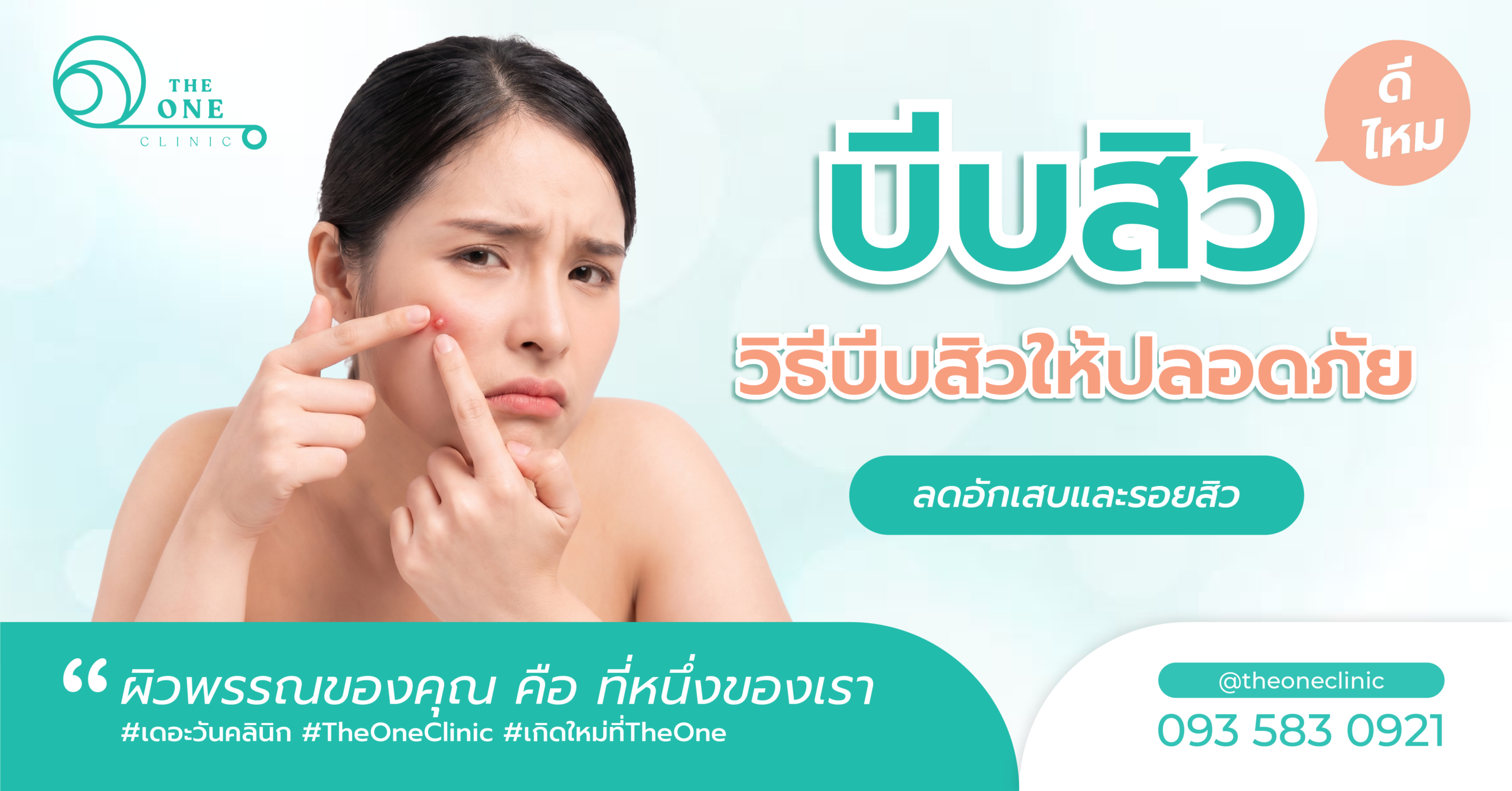 บีบสิวดีไหม? เข้าใจให้ถูกก่อนบีบสิวเพื่อไม่ให้รอยหนักกว่าเดิม
